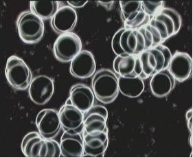 blood test with Amanda harmoniser